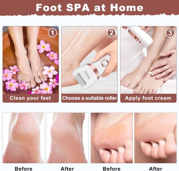 Electric Foot File, Hard Skin Remover Rechargeable Feet Scrubber Shaver Waterproof Callus Remover for Dry Dead Cracked Feet with 3 Roller Heads, White - Image 6