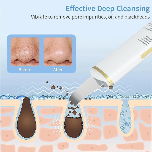 GUGUG Facial Skin Scrubber, Ultrasonic Skin Spatula Face Blackhead Remover Scraper with Four Modes for Deep Cleansing, Portable and Rechargeable Pore Scrubber Include 2 Silicone Covers - Image 4