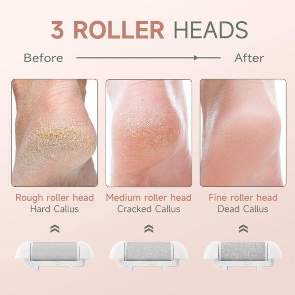Electric Foot File Hard Skin Remover with 3 Roller Heads Rechargeable Pedicure Set Feet Callus Remover for Dry Dead Hard Skin - Image 5