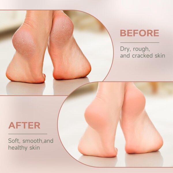 Electric Foot File Hard Skin Remover with 3 Roller Heads Rechargeable Pedicure Set Feet Callus Remover for Dry Dead Hard Skin - Image 8